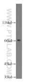 CD1a Molecule antibody, 17325-1-AP, Proteintech Group, Western Blot image 