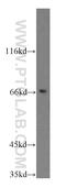 CD1a Molecule antibody, 17325-1-AP, Proteintech Group, Western Blot image 