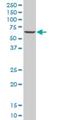 Zinc Finger Protein 215 antibody, H00007762-M03, Novus Biologicals, Western Blot image 