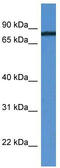 HHIP Like 1 antibody, TA342757, Origene, Western Blot image 