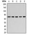 Bestrophin 1 antibody, orb340962, Biorbyt, Western Blot image 
