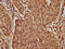 Castor Zinc Finger 1 antibody, CSB-PA773036LA01HU, Cusabio, Immunohistochemistry frozen image 