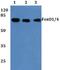 Forkhead Box O1 antibody, A00073-1, Boster Biological Technology, Western Blot image 