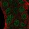 Zinc Finger Protein 488 antibody, NBP2-54918, Novus Biologicals, Immunocytochemistry image 
