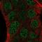 Zinc Finger Protein 488 antibody, NBP2-54918, Novus Biologicals, Immunocytochemistry image 