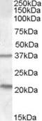 Tumor Suppressor Candidate 3 antibody, MBS421607, MyBioSource, Western Blot image 