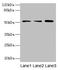 Acyl-CoA Synthetase Bubblegum Family Member 2 antibody, CSB-PA685911LA01HU, Cusabio, Western Blot image 