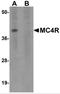 Melanocortin 4 Receptor antibody, 5199, ProSci, Western Blot image 