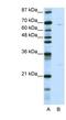 Kelch Like Family Member 13 antibody, NBP1-80047, Novus Biologicals, Western Blot image 