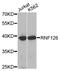 Ring Finger Protein 126 antibody, STJ25368, St John