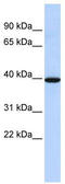 Neuromedin B Receptor antibody, TA344313, Origene, Western Blot image 