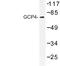 Gamma-tubulin complex component 4 antibody, LS-C177454, Lifespan Biosciences, Western Blot image 