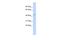 Lysosomal acid phosphatase antibody, A06554, Boster Biological Technology, Western Blot image 