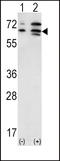 Activin A Receptor Type 2A antibody, LS-B4803, Lifespan Biosciences, Western Blot image 