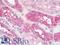 Early Endosome Antigen 1 antibody, LS-B10942, Lifespan Biosciences, Immunohistochemistry frozen image 