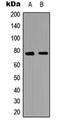 Mitogen-Activated Protein Kinase Kinase Kinase 7 antibody, orb256672, Biorbyt, Western Blot image 