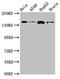 Rho Associated Coiled-Coil Containing Protein Kinase 2 antibody, LS-C679343, Lifespan Biosciences, Western Blot image 