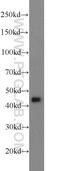 Adhesion Regulating Molecule 1 antibody, 11468-1-AP, Proteintech Group, Western Blot image 