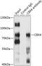 Chromobox 4 antibody, 19-713, ProSci, Immunoprecipitation image 