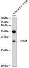 Reprimo, TP53 Dependent G2 Arrest Mediator Homolog antibody, 13-374, ProSci, Western Blot image 