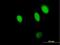 NPL4 Homolog, Ubiquitin Recognition Factor antibody, H00055666-B01P, Novus Biologicals, Immunofluorescence image 