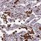 HIC ZBTB Transcriptional Repressor 1 antibody, NBP1-80607, Novus Biologicals, Immunohistochemistry paraffin image 