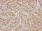 Histone Deacetylase 6 antibody, CSB-RA010242A0HU, Cusabio, Immunohistochemistry frozen image 