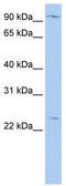 Oxysterol Binding Protein Like 8 antibody, TA335308, Origene, Western Blot image 