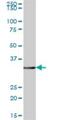 GTPase, IMAP Family Member 7 antibody, H00168537-B01P, Novus Biologicals, Western Blot image 