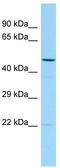 Transmembrane P24 Trafficking Protein 2 antibody, TA331366, Origene, Western Blot image 