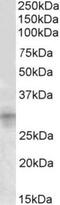 Insulin Like Growth Factor Binding Protein 7 antibody, NBP1-49861, Novus Biologicals, Western Blot image 