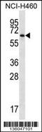 Zinc Finger And BTB Domain Containing 46 antibody, 58-551, ProSci, Western Blot image 