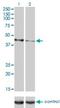 Calreticulin 3 antibody, H00125972-M01, Novus Biologicals, Western Blot image 