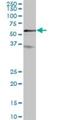 Regulator Of Microtubule Dynamics 3 antibody, H00055177-B01P, Novus Biologicals, Western Blot image 