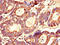 LIM And SH3 Protein 1 antibody, orb46207, Biorbyt, Immunohistochemistry paraffin image 