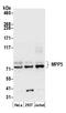 Membrane Palmitoylated Protein 5 antibody, A305-389A, Bethyl Labs, Western Blot image 