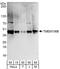 Transmembrane Protein 106B antibody, A303-439A, Bethyl Labs, Western Blot image 