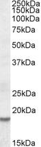 High mobility group protein HMGI-C antibody, EB09623, Everest Biotech, Western Blot image 