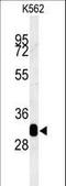 Retinol Dehydrogenase 16 antibody, LS-C162525, Lifespan Biosciences, Western Blot image 