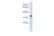 NFKB Inhibitor Alpha antibody, GTX77737, GeneTex, Western Blot image 