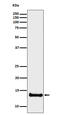 Cystatin B antibody, M02794-1, Boster Biological Technology, Western Blot image 