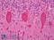 Protein Kinase C Gamma antibody, LS-B7153, Lifespan Biosciences, Immunohistochemistry frozen image 