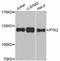 Protein Tyrosine Kinase 2 antibody, LS-C746908, Lifespan Biosciences, Western Blot image 