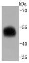 Alpha-1-antitrypsin antibody, NBP2-67135, Novus Biologicals, Western Blot image 