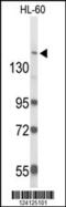 RAB3 GTPase Activating Non-Catalytic Protein Subunit 2 antibody, 64-042, ProSci, Western Blot image 