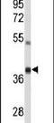 Apoptosis Inducing Factor Mitochondria Associated 2 antibody, PA5-24562, Invitrogen Antibodies, Western Blot image 