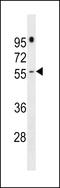 PRAME family member 16 antibody, LS-C158724, Lifespan Biosciences, Western Blot image 