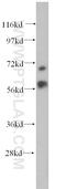 Metastasis Associated 1 Family Member 3 antibody, 14682-1-AP, Proteintech Group, Western Blot image 