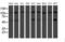 Histidyl-TRNA Synthetase 2, Mitochondrial antibody, M07330, Boster Biological Technology, Western Blot image 