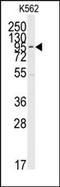 Mitogen-Activated Protein Kinase 7 antibody, AP14118PU-N, Origene, Western Blot image 